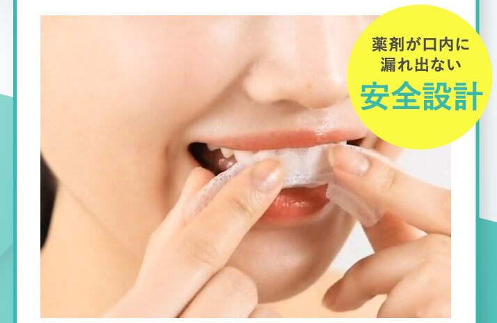 ホワイトニングジェルパックを装着しようとしている画像-1