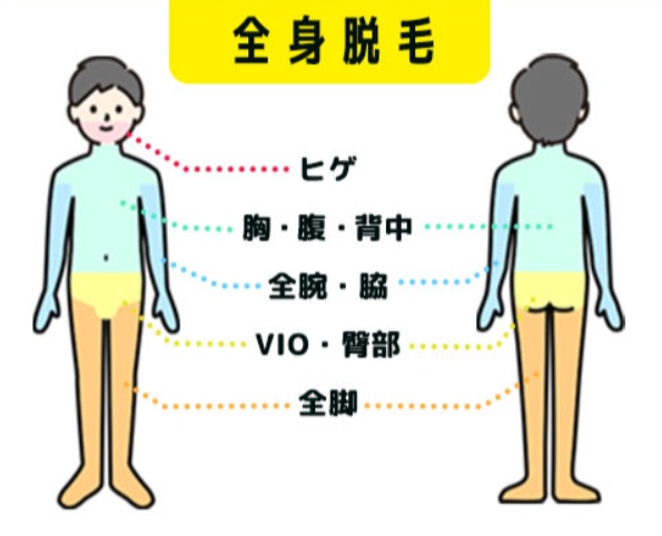 全身脱毛の該当部位を紹介している画像
